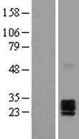Ephrin A2 (EFNA2) Human Over-expression Lysate