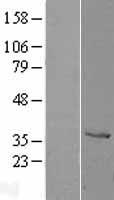 Cathepsin Z (CTSZ) Human Over-expression Lysate