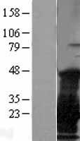 NY-ESO-1 (CTAG1B) Human Over-expression Lysate