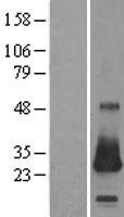 CSRP2 Human Over-expression Lysate
