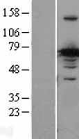 CRMP1 Human Over-expression Lysate
