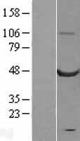 CASQ2 Human Over-expression Lysate