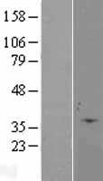 Caspase-6 (CASP6) Human Over-expression Lysate