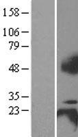 BCMA (TNFRSF17) Human Over-expression Lysate