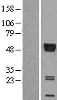 RAGE (AGER) Human Over-expression Lysate