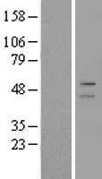 ADFP (PLIN2) Human Over-expression Lysate