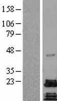 PACAP (ADCYAP1) Human Over-expression Lysate