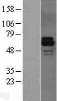 Activin Receptor Type IIB (ACVR2B) Human Over-expression Lysate