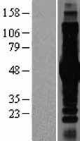 IKK gamma (IKBKG) Human Over-expression Lysate