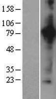 Aconitase 2 (ACO2) Human Over-expression Lysate