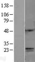 C6orf120 Human Over-expression Lysate