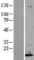 DPPA5 Human Over-expression Lysate