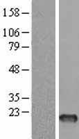 FSH beta (FSHB) Human Over-expression Lysate