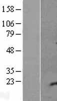 IGIP Human Over-expression Lysate