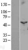 PTGIS Human Over-expression Lysate