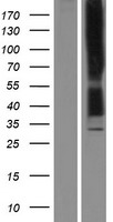 Kappa Opioid Receptor (OPRK1) Human Over-expression Lysate