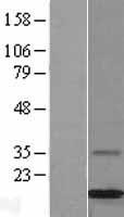 MGP Human Over-expression Lysate