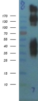 Metabotropic Glutamate Receptor 1 (GRM1) Human Over-expression Lysate