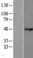 GABA A Receptor beta 1 (GABRB1) Human Over-expression Lysate
