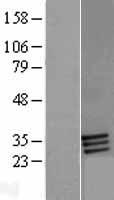 FOLR2 Human Over-expression Lysate