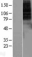 Dopamine Receptor D1 (DRD1) Human Over-expression Lysate