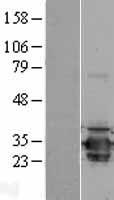 COMT Human Over-expression Lysate