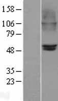 Nicotinic Acetylcholine Receptor beta 2 (CHRNB2) Human Over-expression Lysate