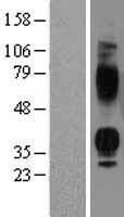 Vasopressin V1b receptor (AVPR1B) Human Over-expression Lysate