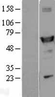 ALDH1A1 Human Over-expression Lysate