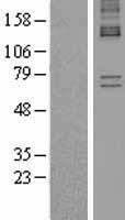 ALAS1 Human Over-expression Lysate