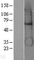 ADH5 Human Over-expression Lysate