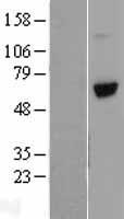 Vitronectin (VTN) Human Over-expression Lysate