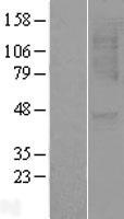 CXCR1 Human Over-expression Lysate