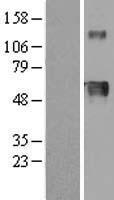 Hemopexin (HPX) Human Over-expression Lysate