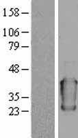 Alpha 1 Acid Glycoprotein (ORM1) Human Over-expression Lysate