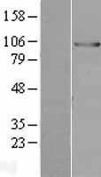 UBE3A Human Over-expression Lysate
