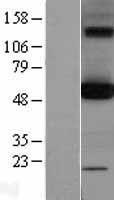 OXCT1 Human Over-expression Lysate
