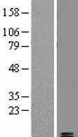 Amylin (IAPP) Human Over-expression Lysate