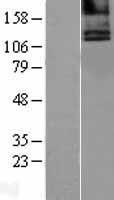 Calcium Sensing Receptor (CASR) Human Over-expression Lysate