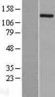 Hamartin (TSC1) Human Over-expression Lysate