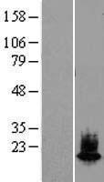 alpha Synuclein (SNCA) Human Over-expression Lysate
