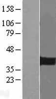 PITX2 Human Over-expression Lysate