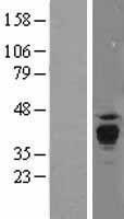 PPT1 Human Over-expression Lysate