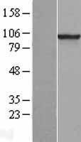 PDE6 beta (PDE6B) Human Over-expression Lysate