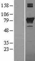 PCCA Human Over-expression Lysate