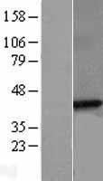 beta Sarcoglycan (SGCB) Human Over-expression Lysate