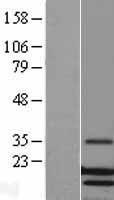 Lysozyme (LYZ) Human Over-expression Lysate