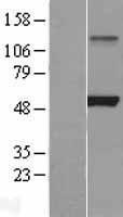 Lipoprotein lipase (LPL) Human Over-expression Lysate