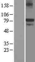 KAL1 (ANOS1) Human Over-expression Lysate
