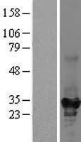 ketohexokinase (KHK) Human Over-expression Lysate